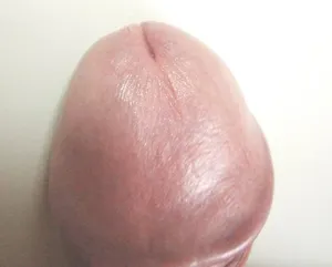 sex